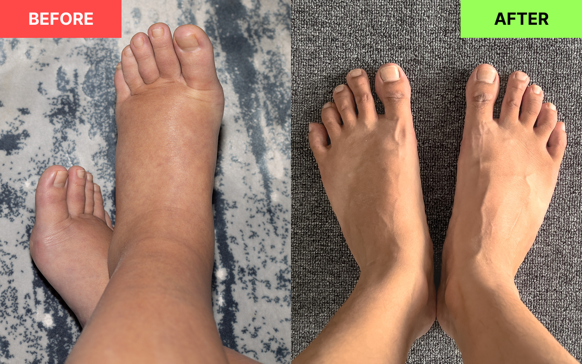 #4 Réduisez les Pieds Gonflés et les Jambes Lourdes